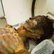 Illustration for article titled 3500-year-old mummy of an Egyptian princess reveals the first known case of coronary artery disease